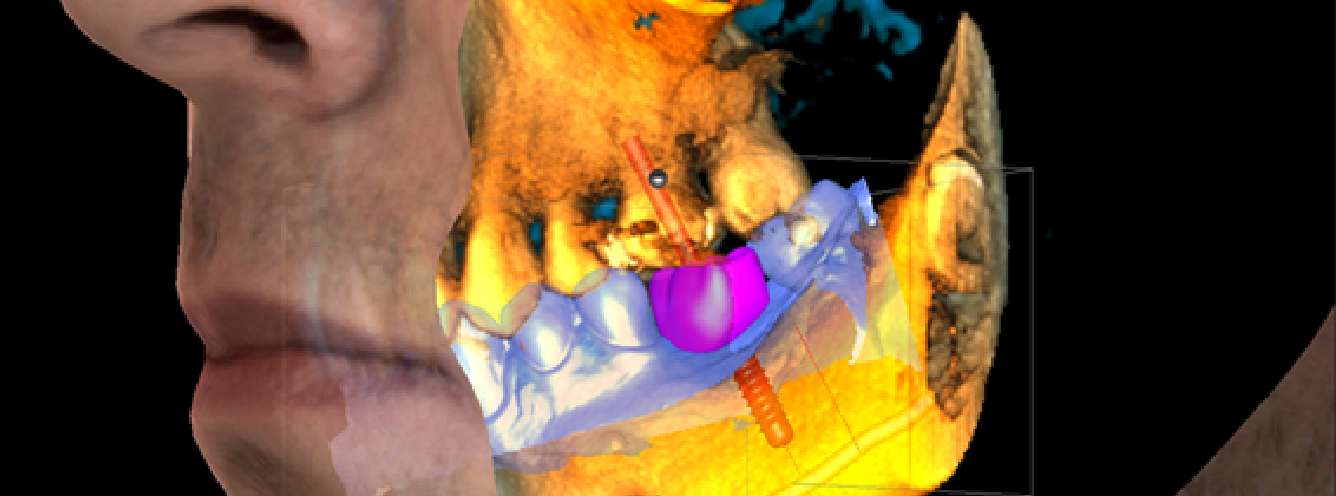 cbct-the-gold-standard-for-imaging