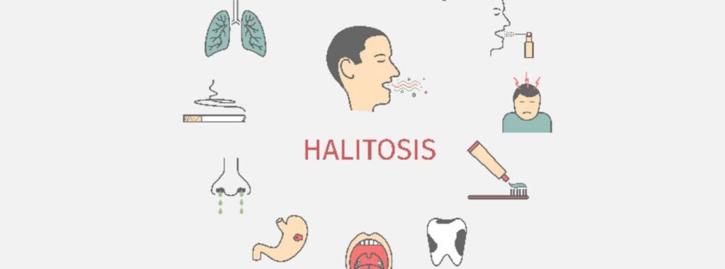 halitosis-better-known-as-bad-breath-part-ii